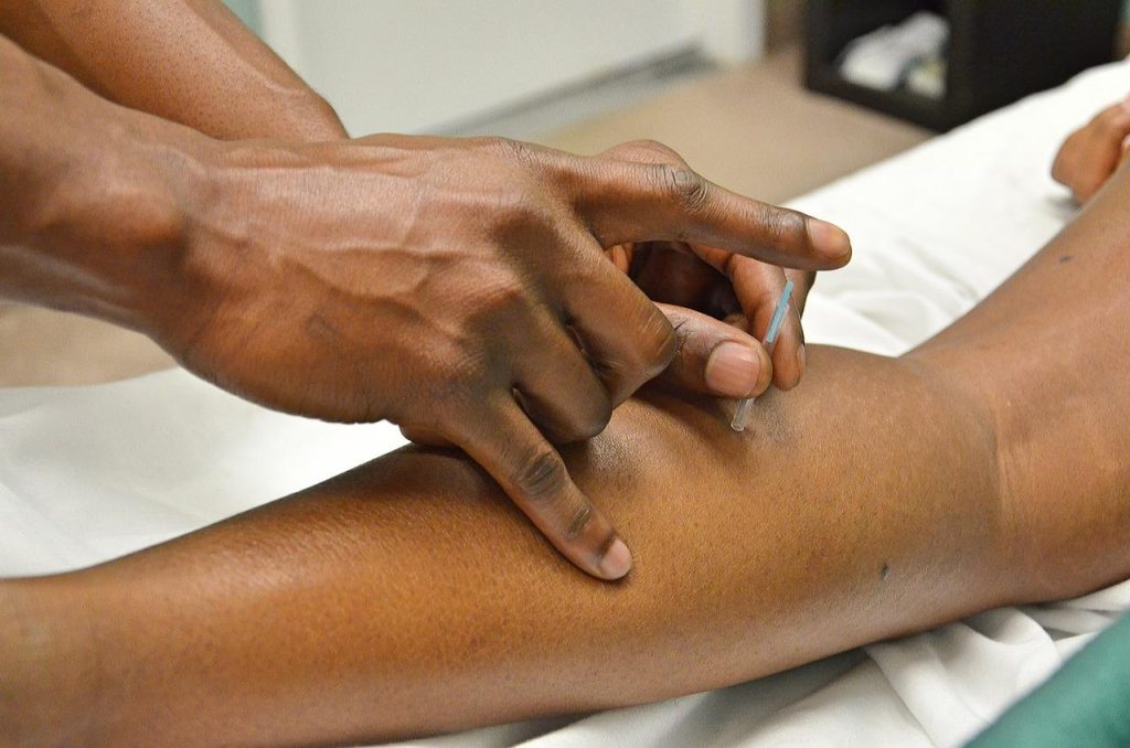 Acupunctuurbehandeling in Doetinchem: terapeut plaatst naalden voor pijnverlichting en stressreductie